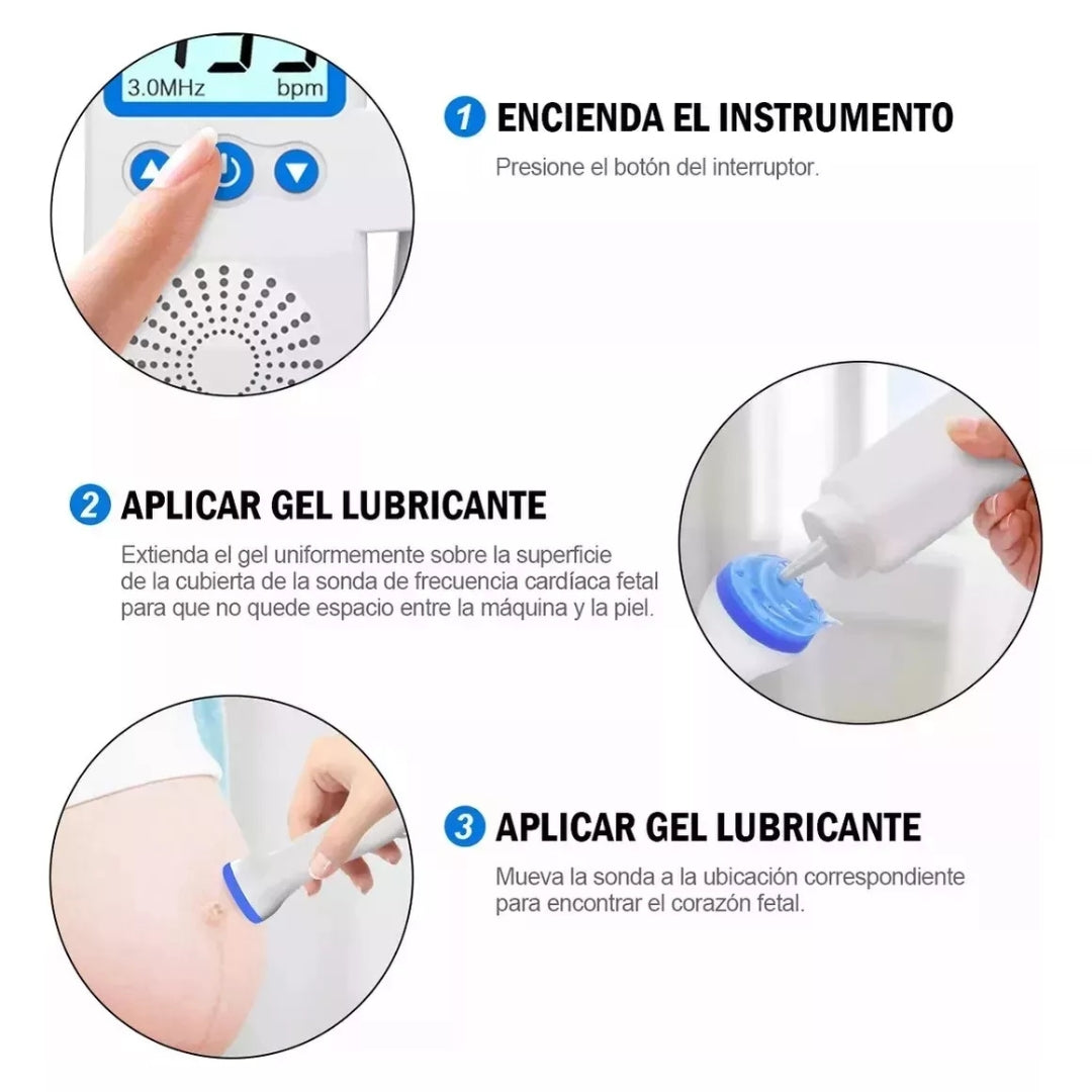 MONITOR ULTRASÓNICO DE BEBE