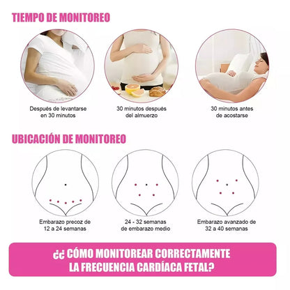 MONITOR ULTRASÓNICO DE BEBE